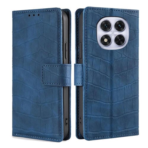 Funda de Piel con Cierre Magnético y Diseño de Cocodrilo para Redmi Note 14 Pro 5G (Azul)